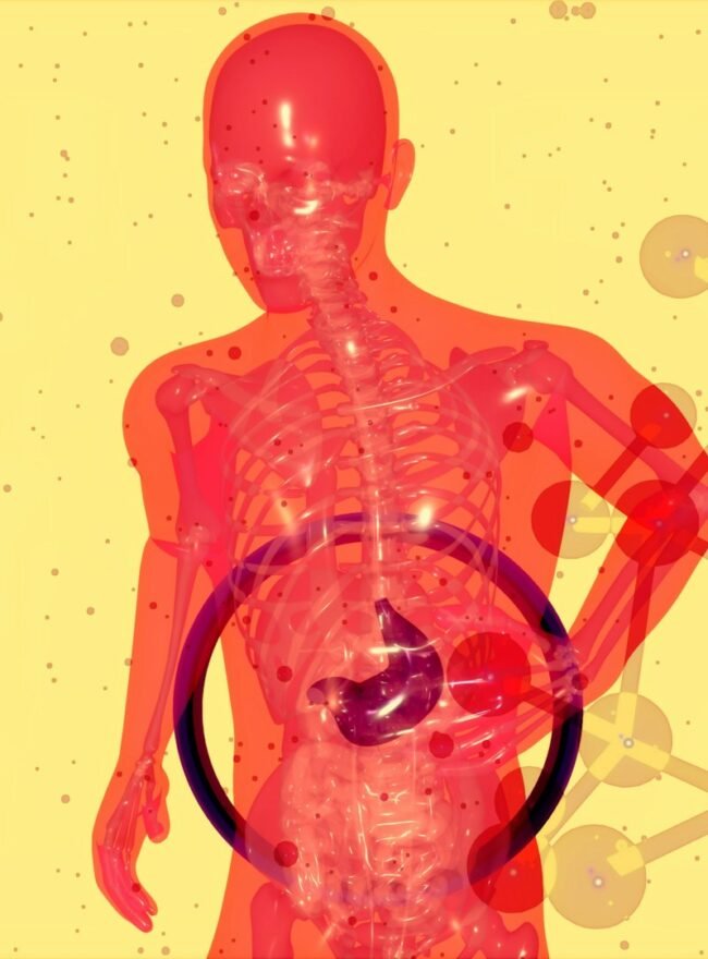 Can Stress Cause Fatty Liver?